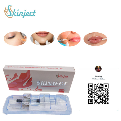 इंजेक्टेबल स्किनजेक्ट डीप हा डर्मल 2 मिली लिप्स फिलर्स चीक चिन नासोलैबियल फोल्ड