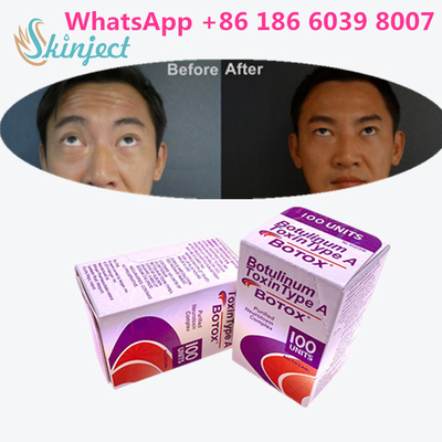 चेहरे की झुर्रियों के लिए बोटुलिनम विष Allergan s 1x100iu