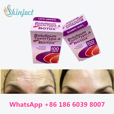 बोटुलिनम विष Allergan  100 Iu 200ui 1 शीशी / बॉक्स