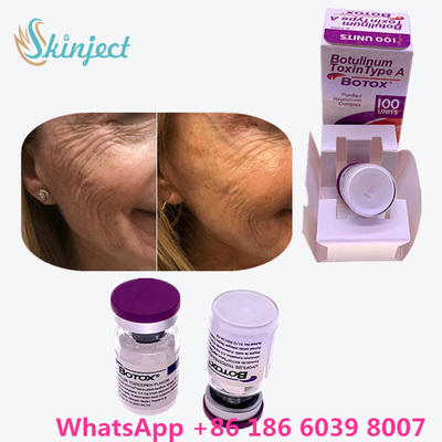 बोटुलिनम विष Allergan  100 Iu 200ui 1 शीशी / बॉक्स