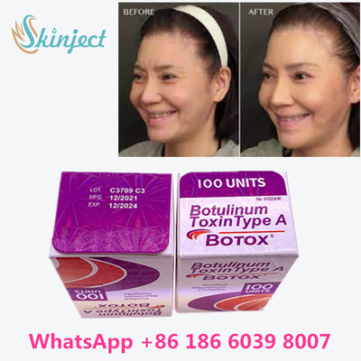 बोटुलिनम विष Allergan  100 Iu 200ui 1 शीशी / बॉक्स