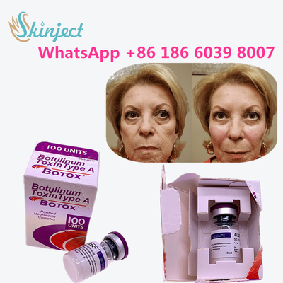 Allergan  Botulinum Toxin Type A त्वचा के एंटी एजिंग उत्पादों के लिए