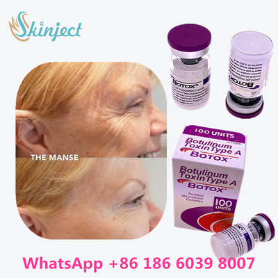Allergan  Botulinum Toxin Type A त्वचा के एंटी एजिंग उत्पादों के लिए