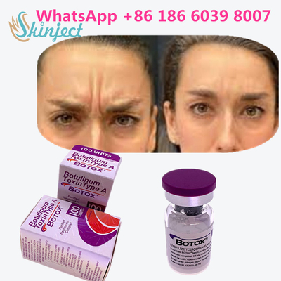 Allergan  Botulinum Toxin Type A त्वचा के एंटी एजिंग उत्पादों के लिए