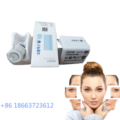 झुर्रियों और सिलवटों के लिए त्वचा की देखभाल एलर्जन बोटुलिनम टॉक्सिन टाइप ए इंजेक्शन