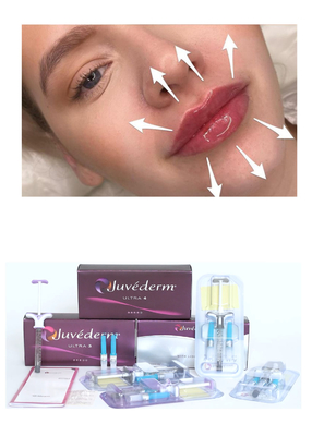 Juvederm' Hyaluronic Acid Dermal Filler Ultra3 Ultra4 Lip Filling के लिए वॉल्यूम इंजेक्शन