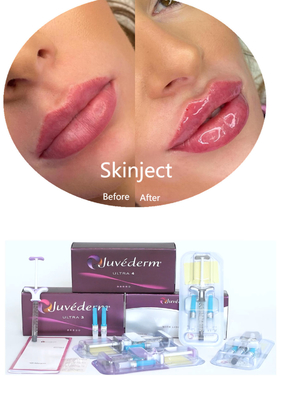 Juvederm Hyaluronic Acid फेशियल डर्मल फिलर इंजेक्शन योग्य 2*1ml पैकिंग