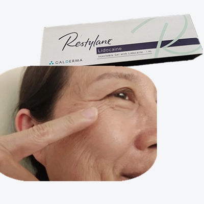 2*1ml/Box Hyaluronic Acid Breast Filler HA माथे की रेखाओं के लिए त्वचा भरने वाले