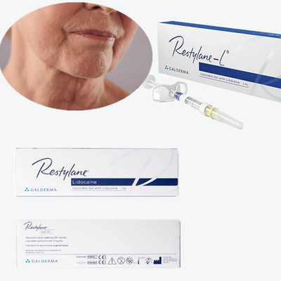 2*1ml/बॉक्स इंजेक्शन योग्य त्वचा भराव HA नासोलैबियल लाइनों और झुर्रियों के लिए भराव