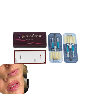 Juvederm होंठ इंजेक्शन के लिए त्वचा भराव Hyaluronic एसिड भराव
