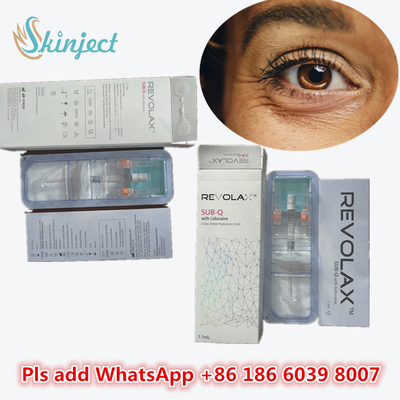 मेडिकल सोडियम हाइलूरोनेट जेल हाइलूरोनिक एसिड Dermal Revolax Deep Filler 1ml होंठ इंजेक्शन के लिए