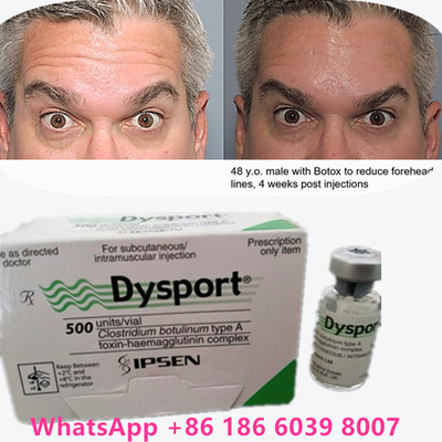 बोटुलिनम विषाक्तता बोटॉक्स पाउडर Dysport 100iu/1vials उम्र बढ़ने वाली त्वचा के लिए