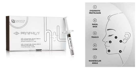 प्राकृतिक दिखने वाली लिफ्ट 5- बिंदु लिफ्टिंग सुई Profhilo इंजेक्शन योग्य त्वचा भराव