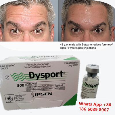 Botulinum Toxin Dysport Botox Clostridium Botulinum Type A बरौनी उठाने के लिए