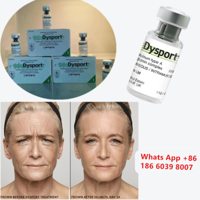 गाल बढ़ाने के लिए Dysport 500u Botulinum Toxin Type A