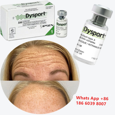 गाल बढ़ाने के लिए Dysport 500u Botulinum Toxin Type A