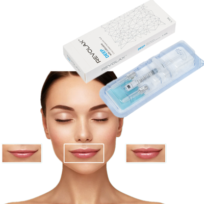 OEM 1.1ml Revolax Fine Deep Sub-Q Fine Line और सूक्ष्म त्वचा कायाकल्प के लिए हल्के त्वचा भराव