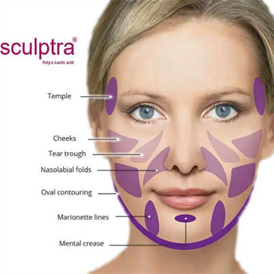 कोलेजन को उत्तेजित करने के लिए CE मूर्तिकला PLLA पाउडर