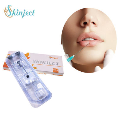 Hyaluronic एसिड त्वचीय भराव होंठ इंजेक्शन 1ml 2ml 5ml डर्म होंठ प्रत्यारोपण