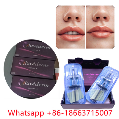 जुवेडर्म अल्ट्रा 4 (2x1ml) इंजेक्टेबल डर्मल फिलर लिप इज़ाफ़ा