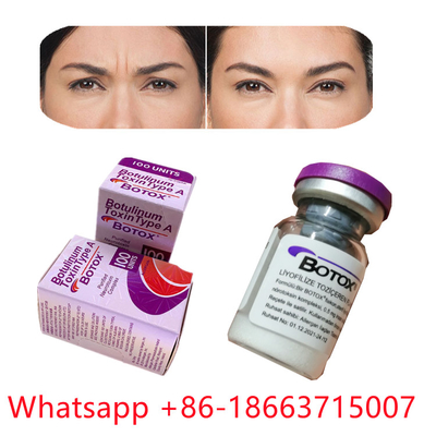 एलर्जेन बोटुलिनम टॉक्सिन टाइप ए बोटॉक्स पाउडर फॉर्म