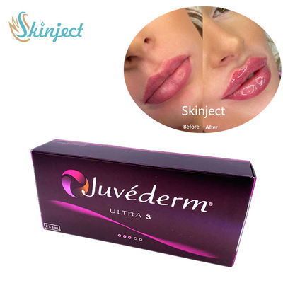 Juvederm Ultra3 2x1ml हयालूरोनिक एसिड फेशियल फिलर्स डर्मल