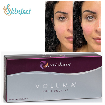 चीकबोन के लिए Juvederm Voluma 2x1ml हयालूरोनिक एसिड डर्मल फिलर्स