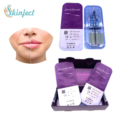 Juvederm Ultra4 होंठ इज़ाफ़ा त्वचीय भराव हयालूरोनिक एसिड