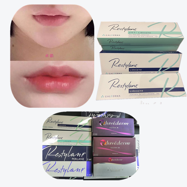 क्रॉस लिंक्ड हाइलूरोनिक एसिड डर्मल फिलर एंटी एजिंग उत्पाद