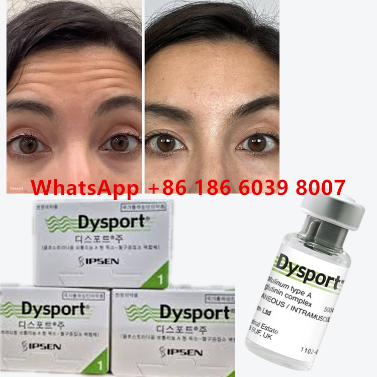 Botulinum Toxin Dysport Clostridium Botulinum Type A 500 यूनिट/ फ्लास्क