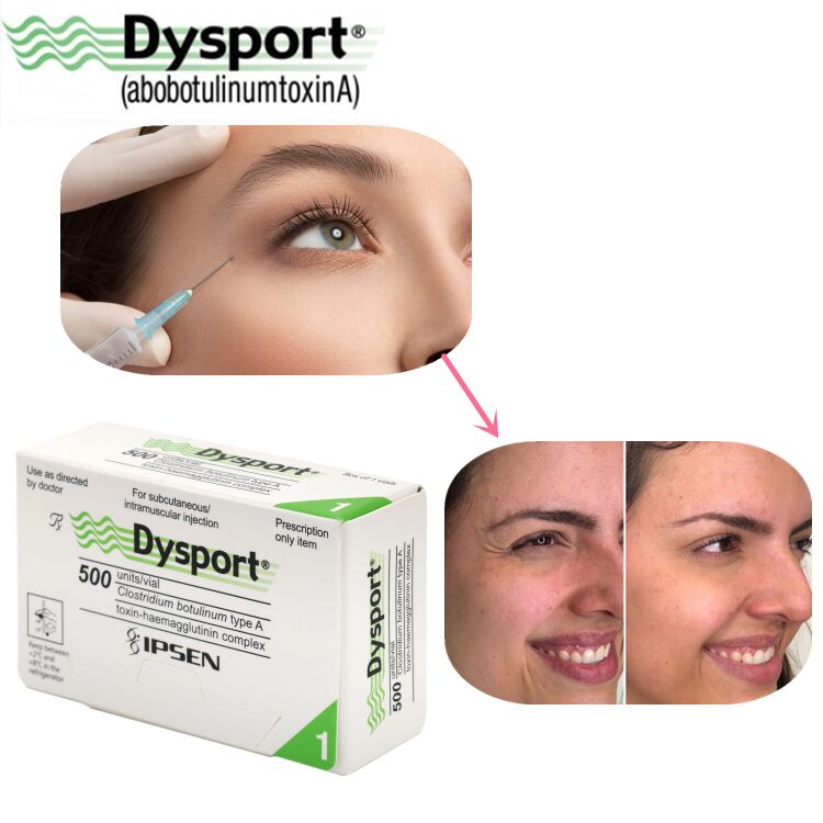 500u Dysport चेहरे की झुर्रियों का गायब होना फ्रीज-ड्राइंग पाउडर प्रोसेसिंग कस्टम OEM Dysport