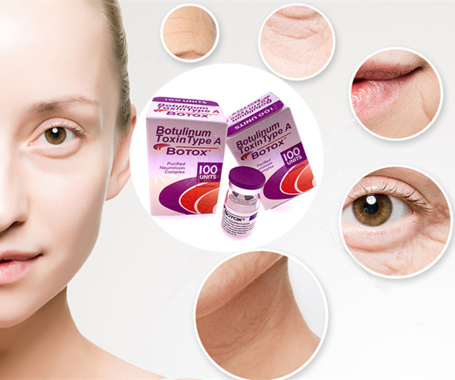 Meditoion 50 इकाइयाँ Botuliunm विष प्रकार A 100 इकाइयाँ Allergan