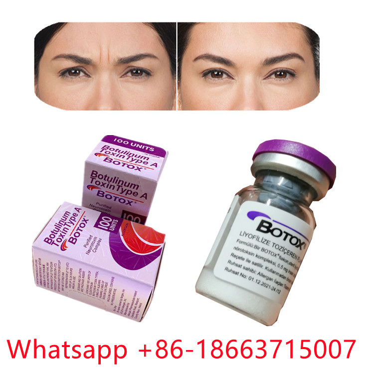 एलर्जेन बोटुलिनम टॉक्सिन टाइप ए बोटॉक्स पाउडर फॉर्म