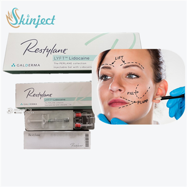 कौवा के पैरों के लिए Hyaluronidase Solution रेस्टलेन लिडोकेन हा त्वचीय भराव