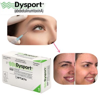 500u Dysport चेहरे की झुर्रियों का गायब होना फ्रीज-ड्राइंग पाउडर प्रोसेसिंग कस्टम OEM Dysport
